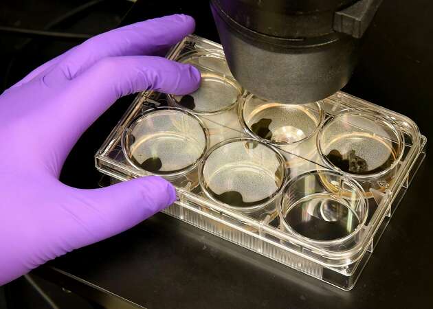 Study sounds alarm over rise of clinics offering stem cell therapies